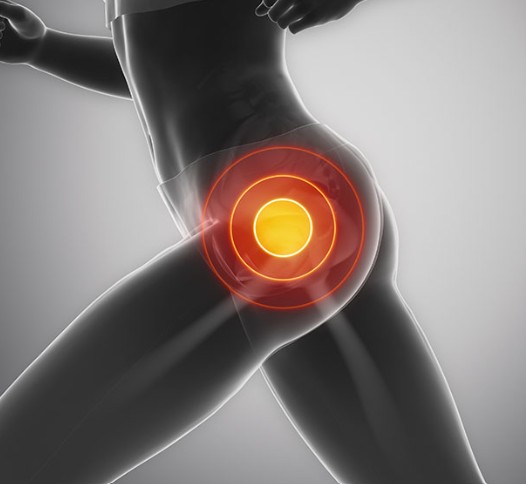Hip Pain